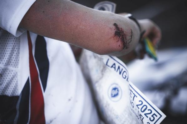 Et bilde som inneholder person, håndskrift, rist, tatoveringKI-generert innhold kan være feil.