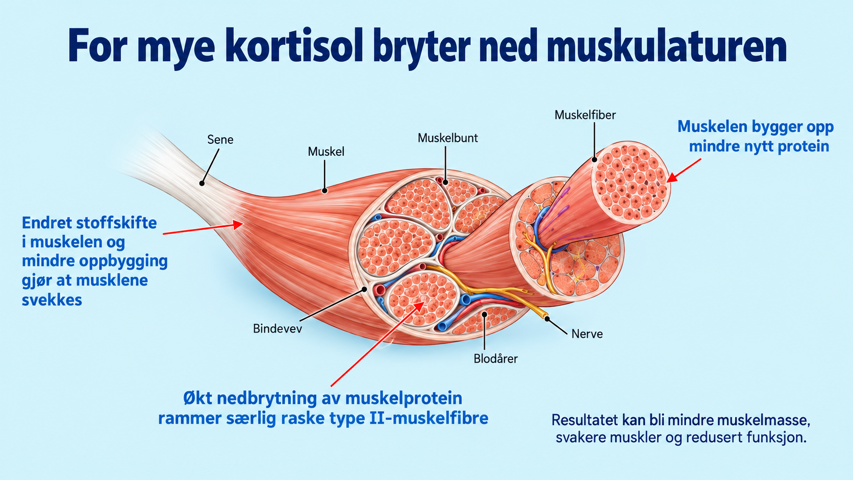 Image for Muskelsvakhet ved cushing og akromegali