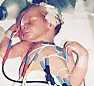 Min historie: Barn med CAH Henrik